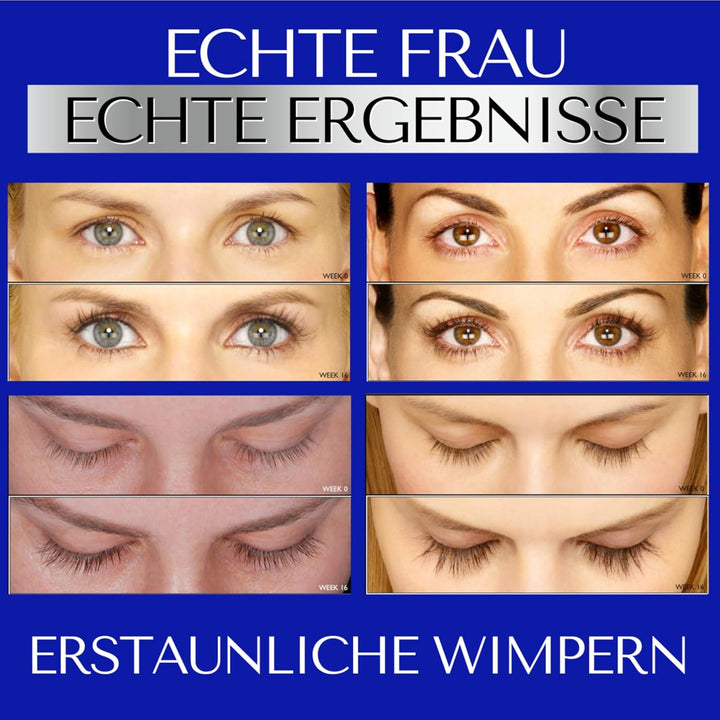 WIE IN VOGUE UK GESEHEN: Spectaculash Lash Serum – Wimpernserum für Wachstum und Dicke – Peptidserum
