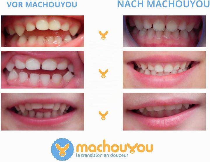 Machouyou nach Schnuller