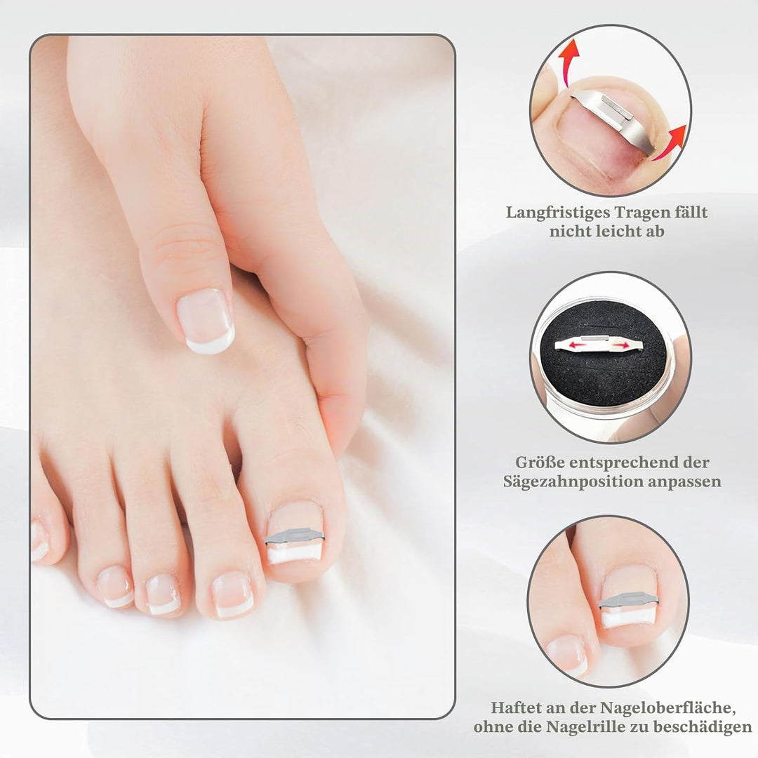 4 Stück Eingewachsene Zehennägel Set Fussnagel Eingewachsen Spange Nagelspangen Für Fussnägel Zehenn