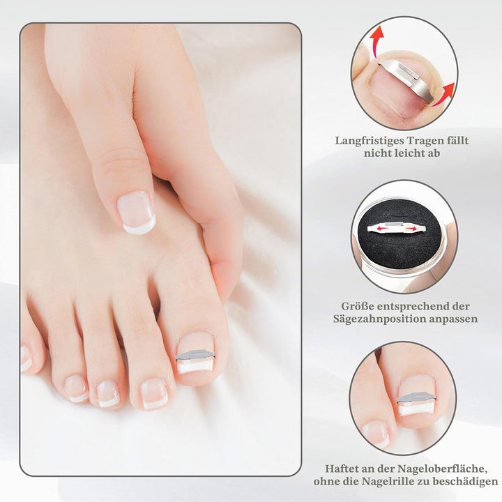 4 Stück Eingewachsene Zehennägel Set Fussnagel Eingewachsen Spange Nagelspangen Für Fussnägel Zehenn