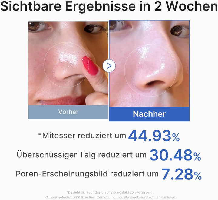 Medicube Zero Pore Pad 2.0 155g (70 Pads)