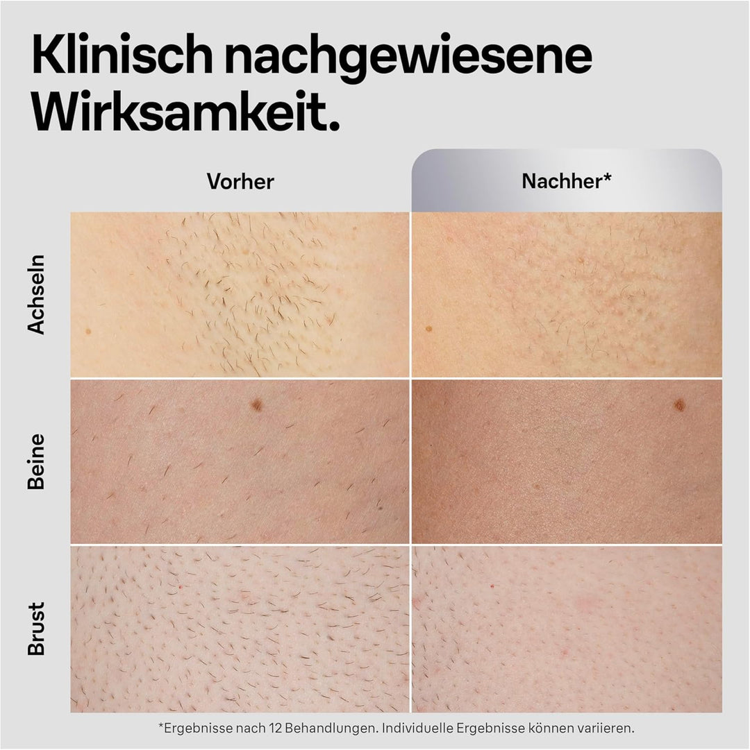 Braun IPL Silk Expert Pro 5 Haarentfernungsgerät Herren, sichtbare Haarentfernung für Männer, Design