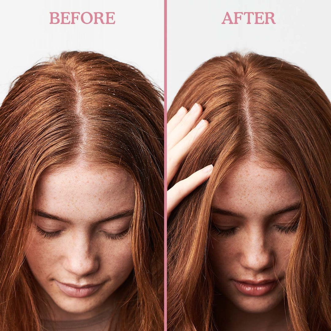 Umberto Giannini Scalp Restore Conditioner 250ml Anti-Schuppen Conditioner, 250 ml, Anti-Schuppen Co