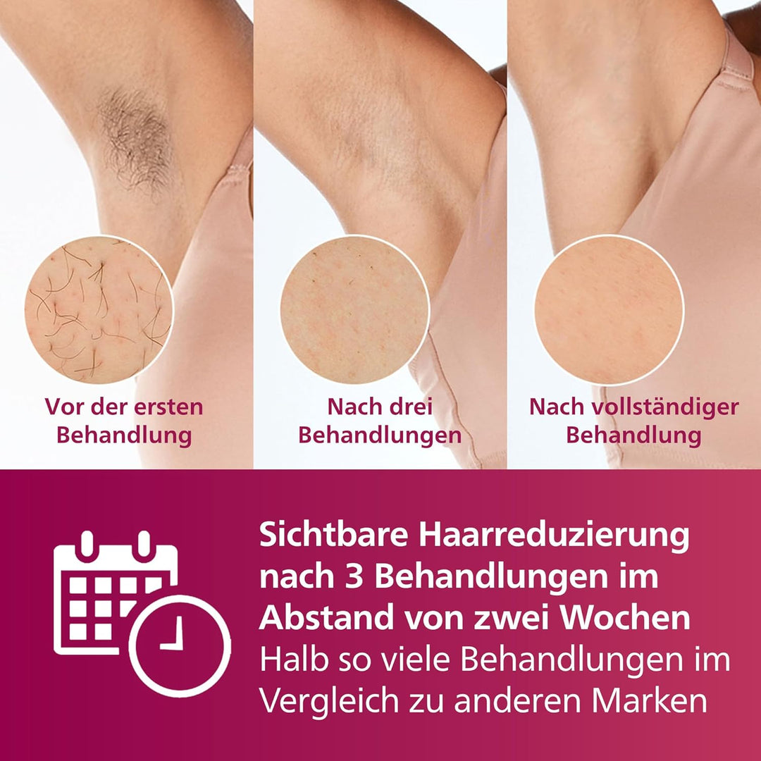 Philips Lumea IPL Advanced, 3 Aufsätze – Haarentfernungsgerät mit Satin Compact Korrekturtrimmer