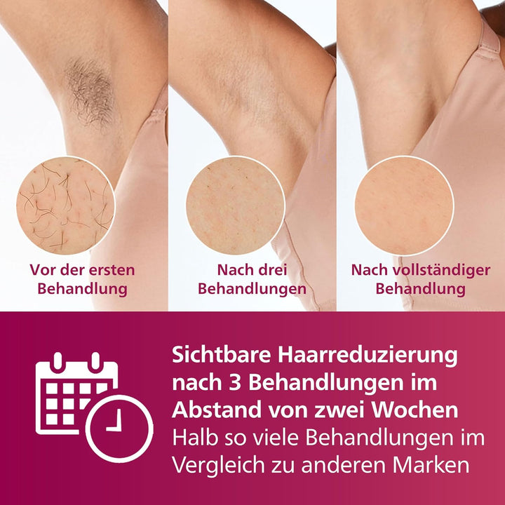 Philips Lumea IPL Advanced, 3 Aufsätze – Haarentfernungsgerät mit Satin Compact Korrekturtrimmer