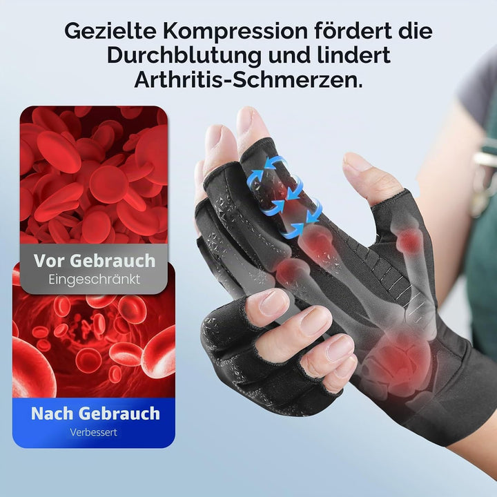 Donfri 2 Paar Kupfer- Arthritis-Kompressionshandschuhe für Damen und Herren,Schwarz (XL) XL Schwarz