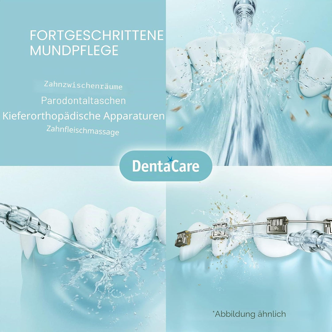Panasonic WEW0983 Ersatzkanüle für Munddusche EW1511, 2 Stück WEW0983X503, WEW0983X503