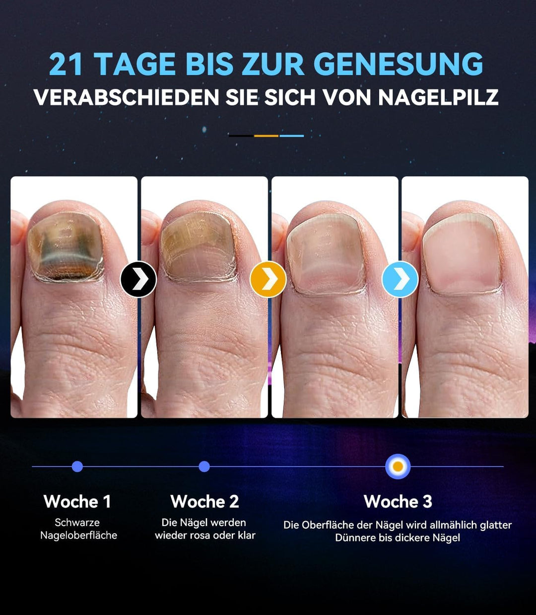 6.0 Nagelpilz Laser mit Zeitmessgerät Nagelpilz Lasergerät【3 Blau 1 Infrarot-Stärkste Wirkung】Laser