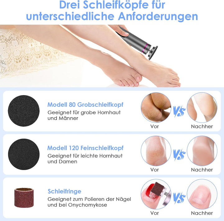 2-in-1 Elektrischer Hornhautentferner mit Nagelfräser, 9 Geschwindigkeiten, LED-Batterieanzeige, Wie
