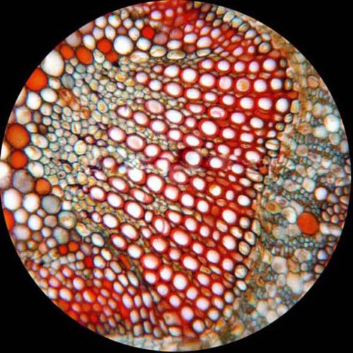 AmScope T490B-10M Trinokulares Biologisches Verbundmikroskop mit 10MP USB-Digitalkamera, 40X-2000X,