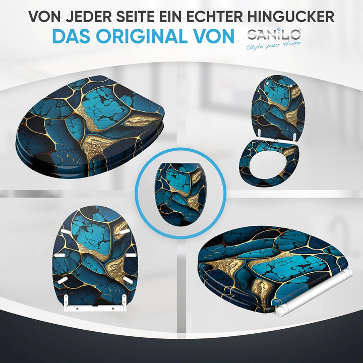 Sanilo WC Sitz mit Absenkautomatik & Schnellverschluss, Toilettendeckel per Knopfdruck abnehmbar, ei