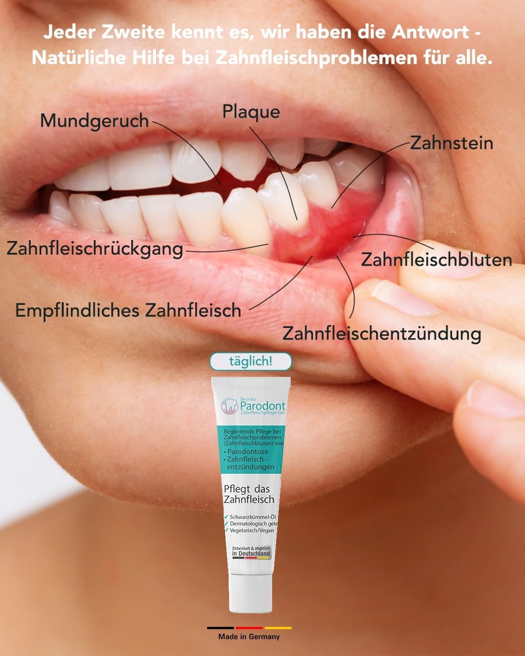 Beovita Parodont Zahnfleischpflege Gel 5er-Set (5 x 10 ml)
