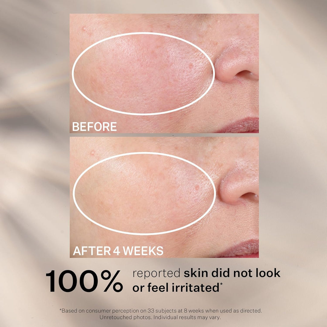 StriVectin Fortschrittliche Retinol Intensive Nacht-Feuchtigkeitscreme, die sichtbare Zeichen des Al