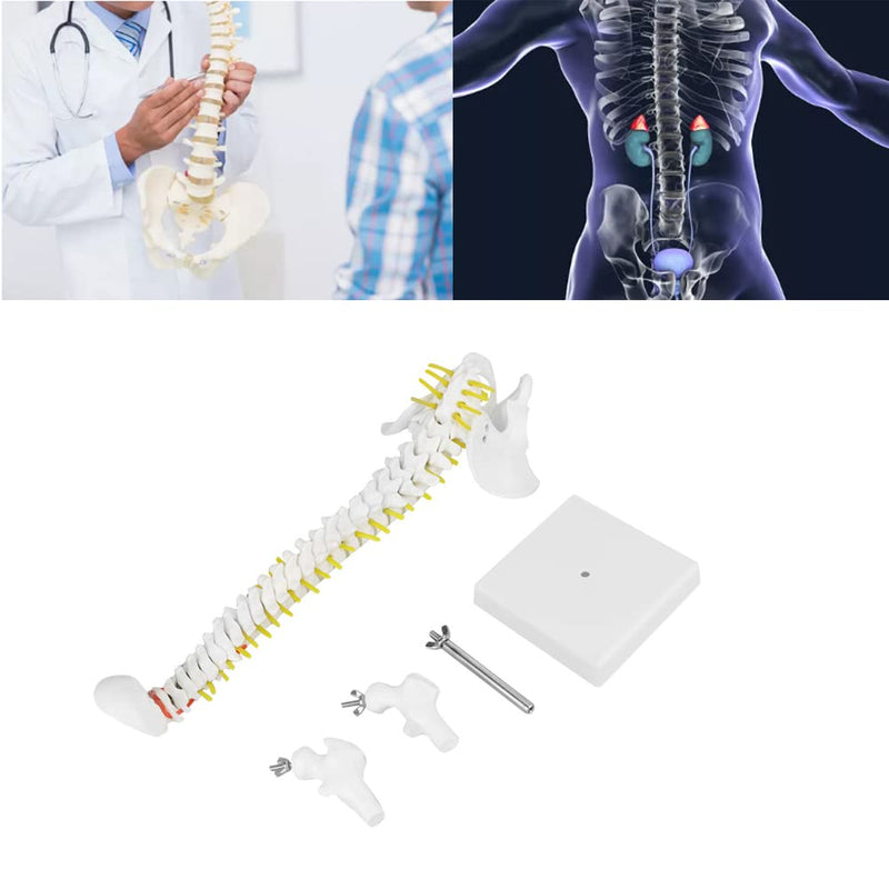 Wirbelsäule Modell, Wissenschaftliches Menschliches Wirbelsäulenmodell 45 cm Lebensgrosses Abnehmbar
