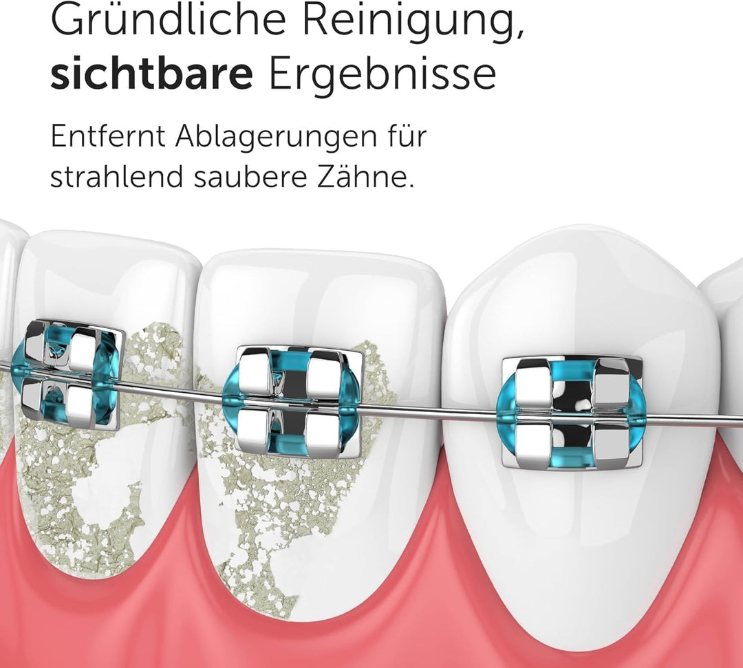 Wondersmile Munddusche PRO - Testsieger 2024-100 Tage risikofrei testen - SmoothFlow-Technologie für