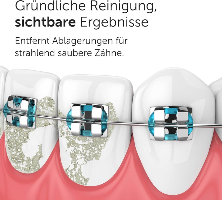 Wondersmile Munddusche PRO - Testsieger 2024-100 Tage risikofrei testen - SmoothFlow-Technologie für
