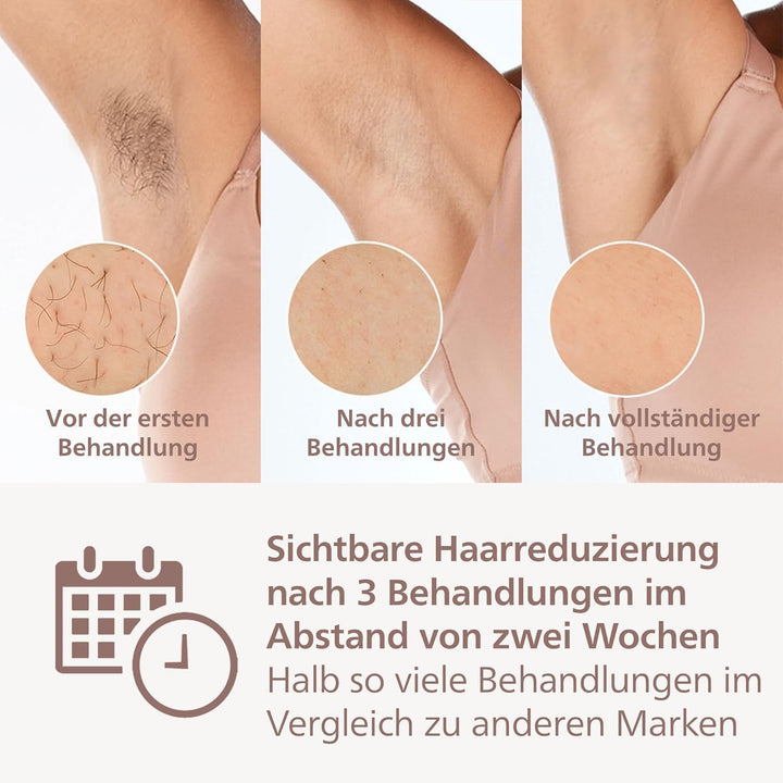 Set aus Philips Lumea IPL 9000 Series Haarentfernungsgerät mit SenseIQ Technologie (BRI957/00) + PHI