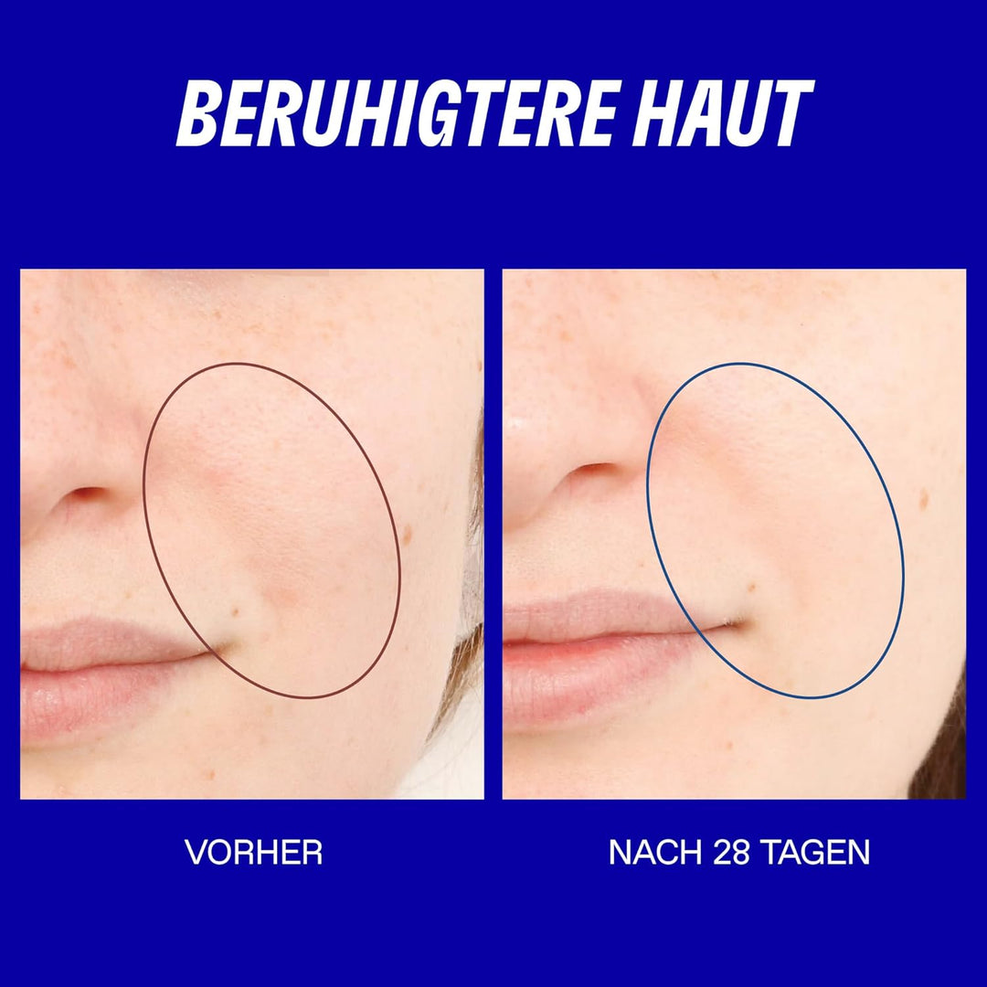 KORRES GREEK YOGHURT Nährendes probiotisches Serum für das Gesicht, beruhigende Pflege für gerötete