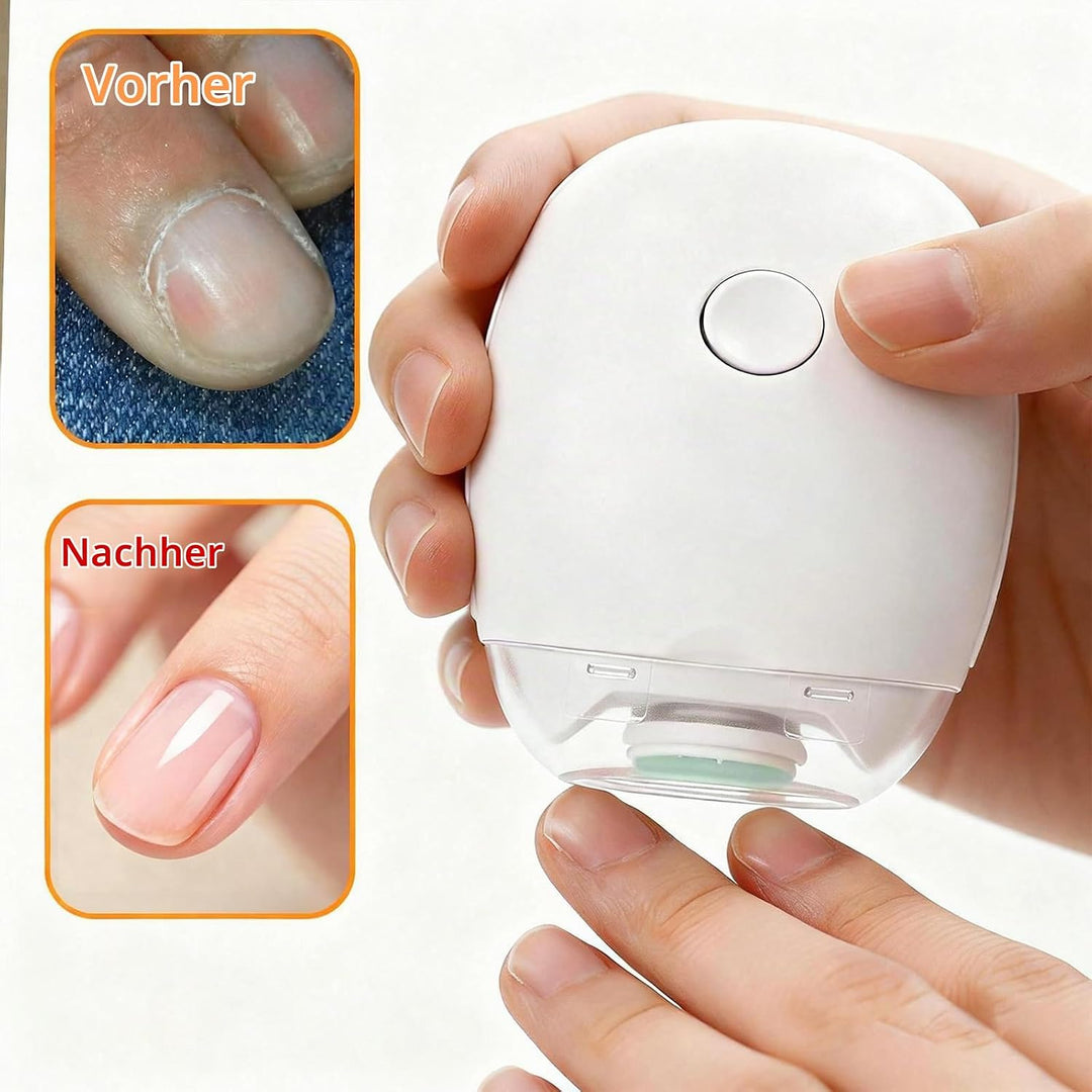 2 Stück Universeller Elektrischer Nagelknipser &amp; Nagelfeile, Automatische Wiederaufladbare Nagelpfle