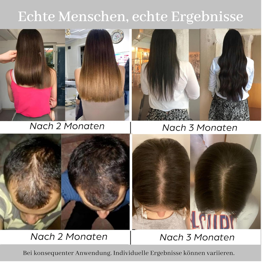 Diamond Hair Plus - Natürliches Keratin Haarserum mit Biotin - und Procapil - Unterstützung - Haarku