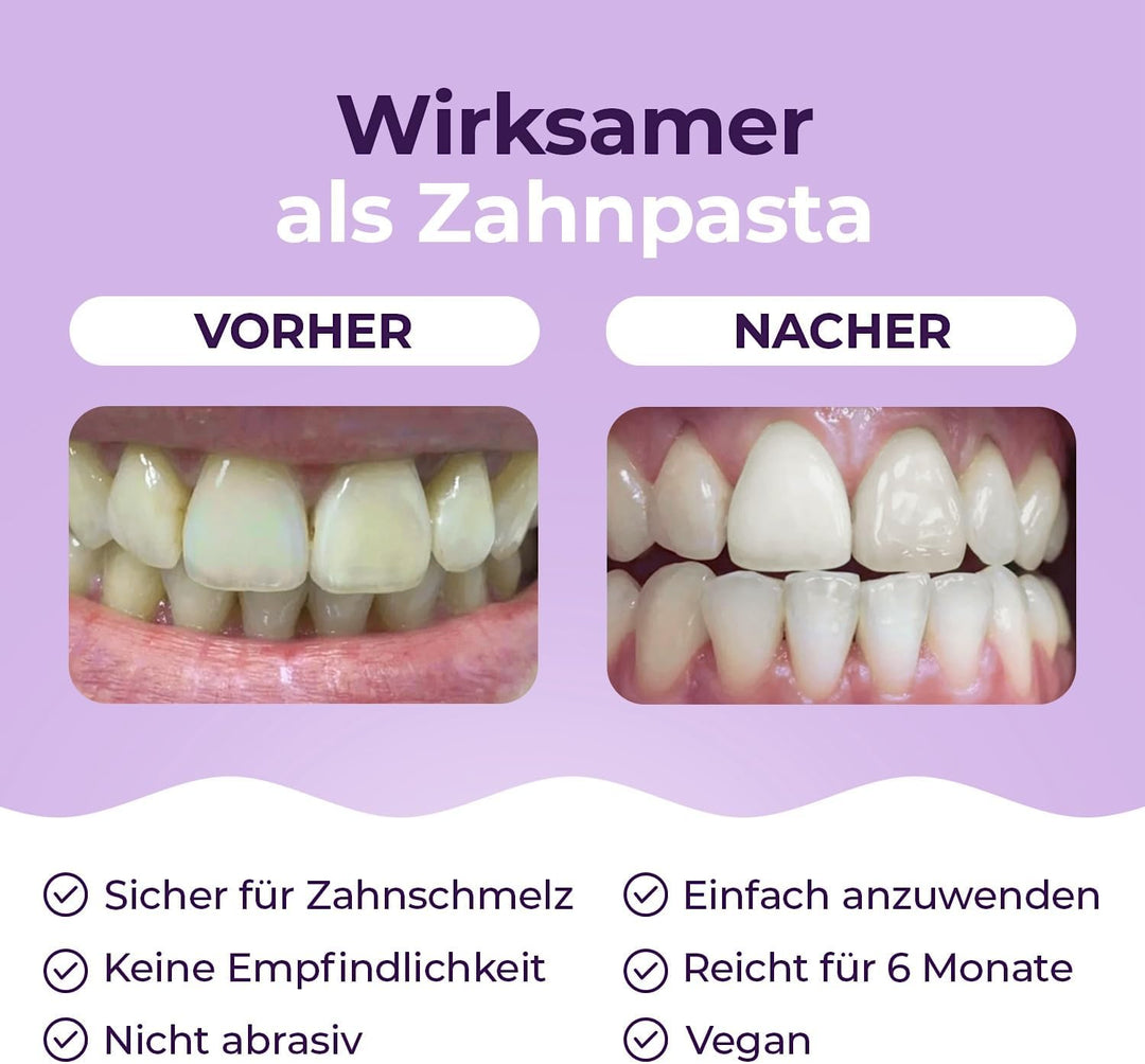 Onlysmile Teeth Whitening Pulver für weisse Zähne | Zahnaufhellung und Bleaching Pulver mit sichtbar