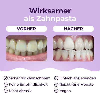 Onlysmile Teeth Whitening Pulver für weisse Zähne | Zahnaufhellung und Bleaching Pulver mit sichtbar