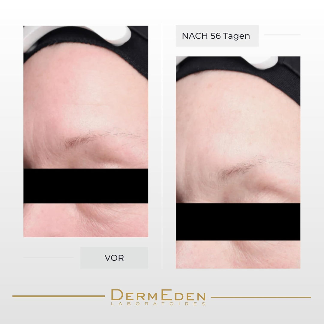 DermEden - Regenerierende Nachtcreme 50 ml - Fördert die Zellerneuerung für eine prallere, straffere