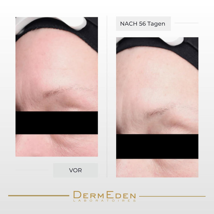 DermEden - Regenerierende Nachtcreme 50 ml - Fördert die Zellerneuerung für eine prallere, straffere