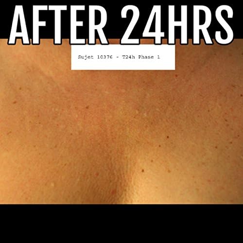 La Decollette Original faltenfreie Dekolettee Schlaf BH Uni Grösse