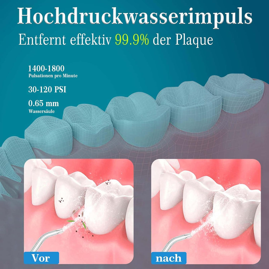 SURFOU Munddusche Kabellos Mundduschen 230ML 5 Modi 7 Düsen, Mundduschen Reise Water Flosser IPX7 Wa