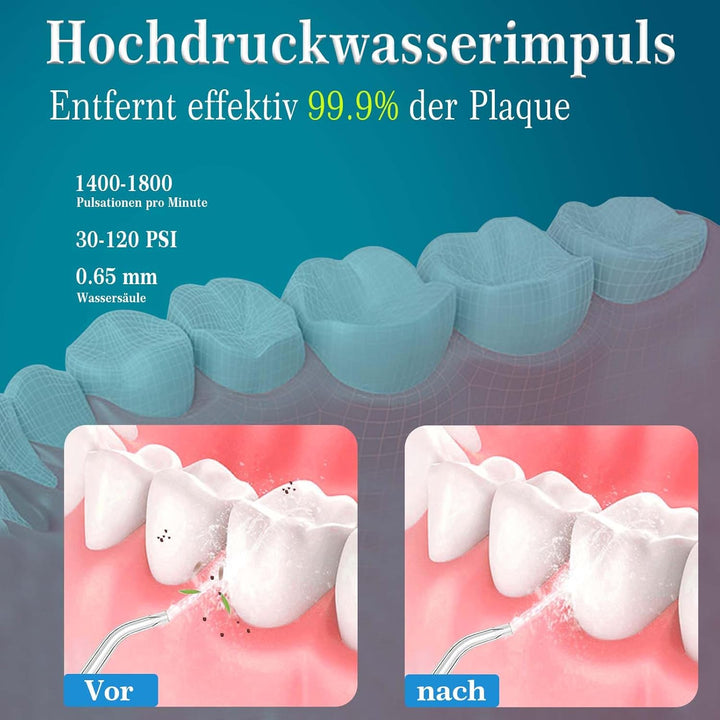 SURFOU Munddusche Kabellos Mundduschen 230ML 5 Modi 7 Düsen, Mundduschen Reise Water Flosser IPX7 Wa
