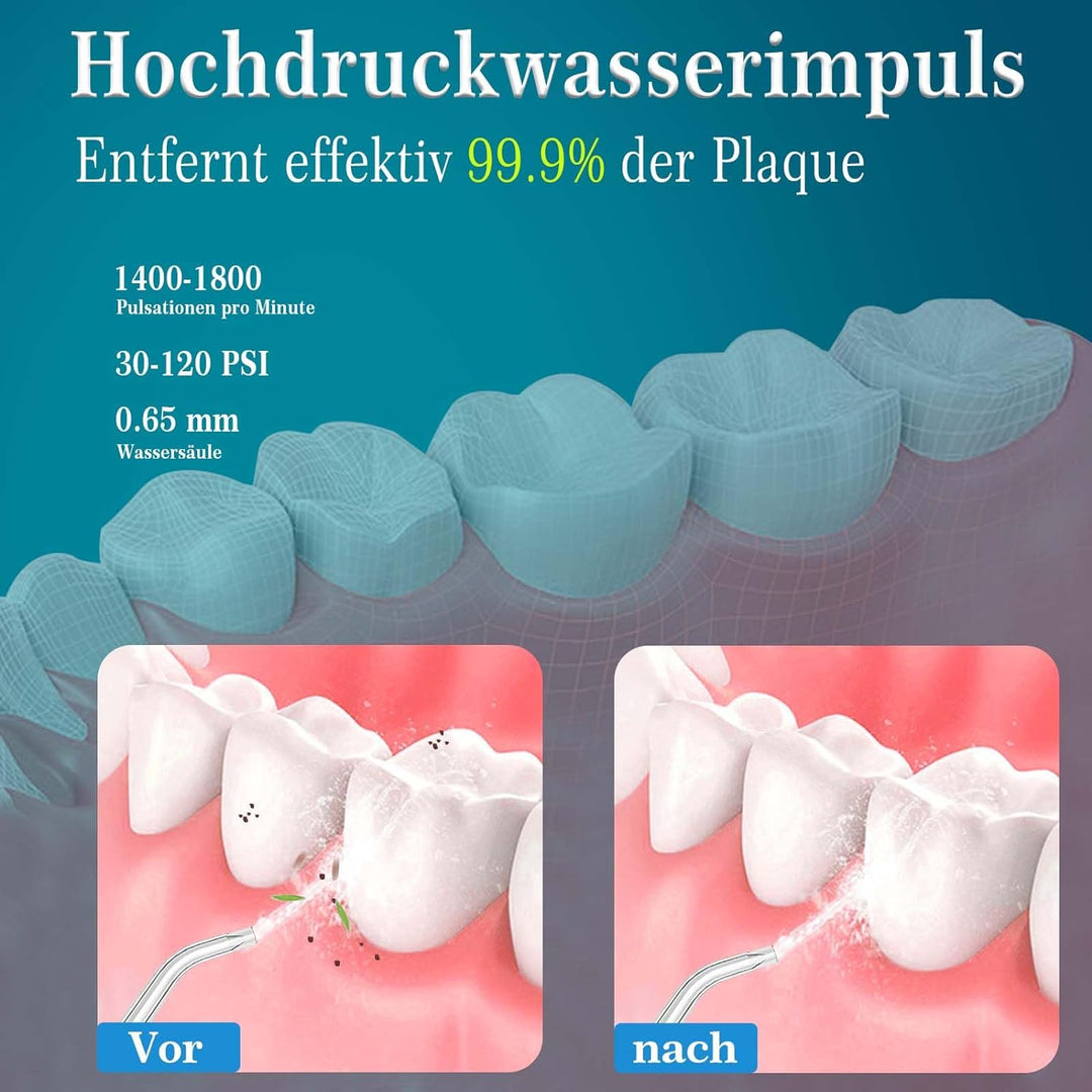 SURFOU Munddusche Kabellos Mundduschen 230ML 5 Modi 7 Düsen, Mundduschen Reise Water Flosser IPX7 Wa