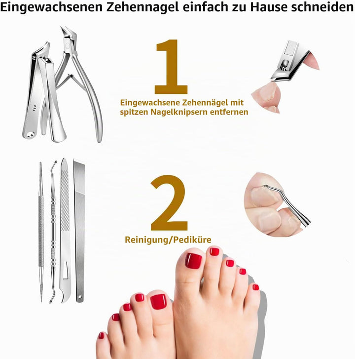 EBEWANLI Set zum Entfernen eingewachsener Zehennägel, 6-teilig Silber, Silber