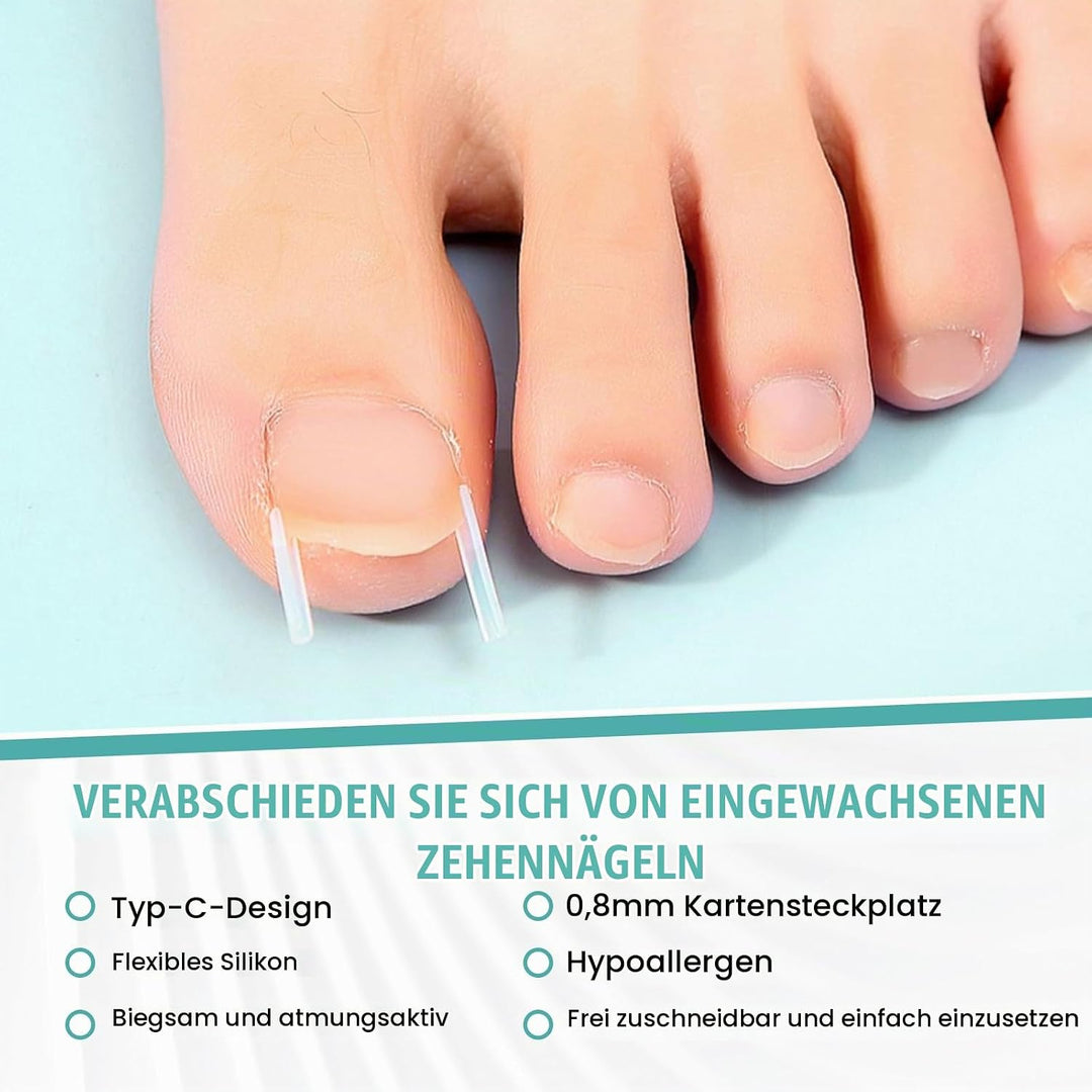 152 Pcs Nagelspange FussNäGel,Eingewachsene ZehennäGel Set,Zehennagel Eingewachsen,Nagelspange FussN