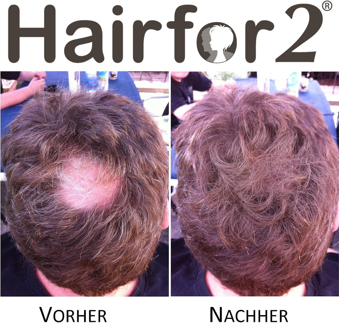 Hairfor2 Haarverdichtungsspray gegen lichtes Haar | Haarpuder | Streuhaar | Haarauffüller | Haarausf