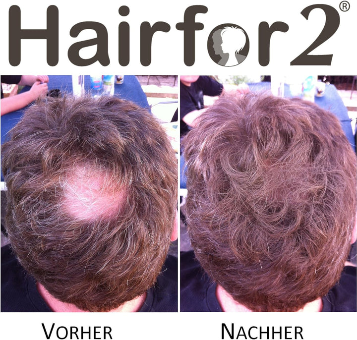 Hairfor2 Haarverdichtungsspray gegen lichtes Haar | Haarpuder | Streuhaar | Haarauffüller | Haarausf