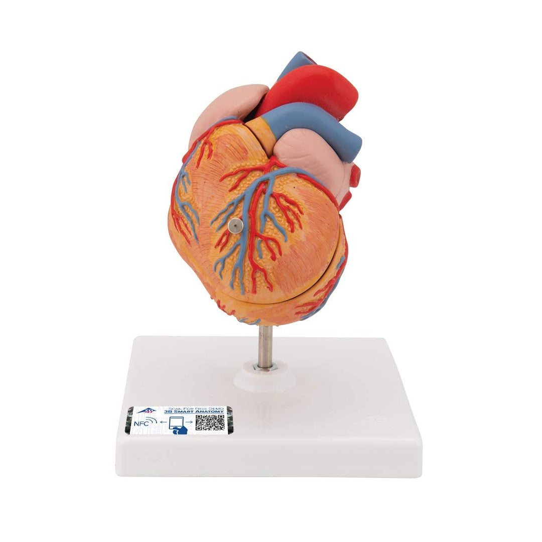 3B Scientific Menschliche Anatomie - Klassik-Herzmodell mit linksventrikulärer Hypertrophie (LVH), 2