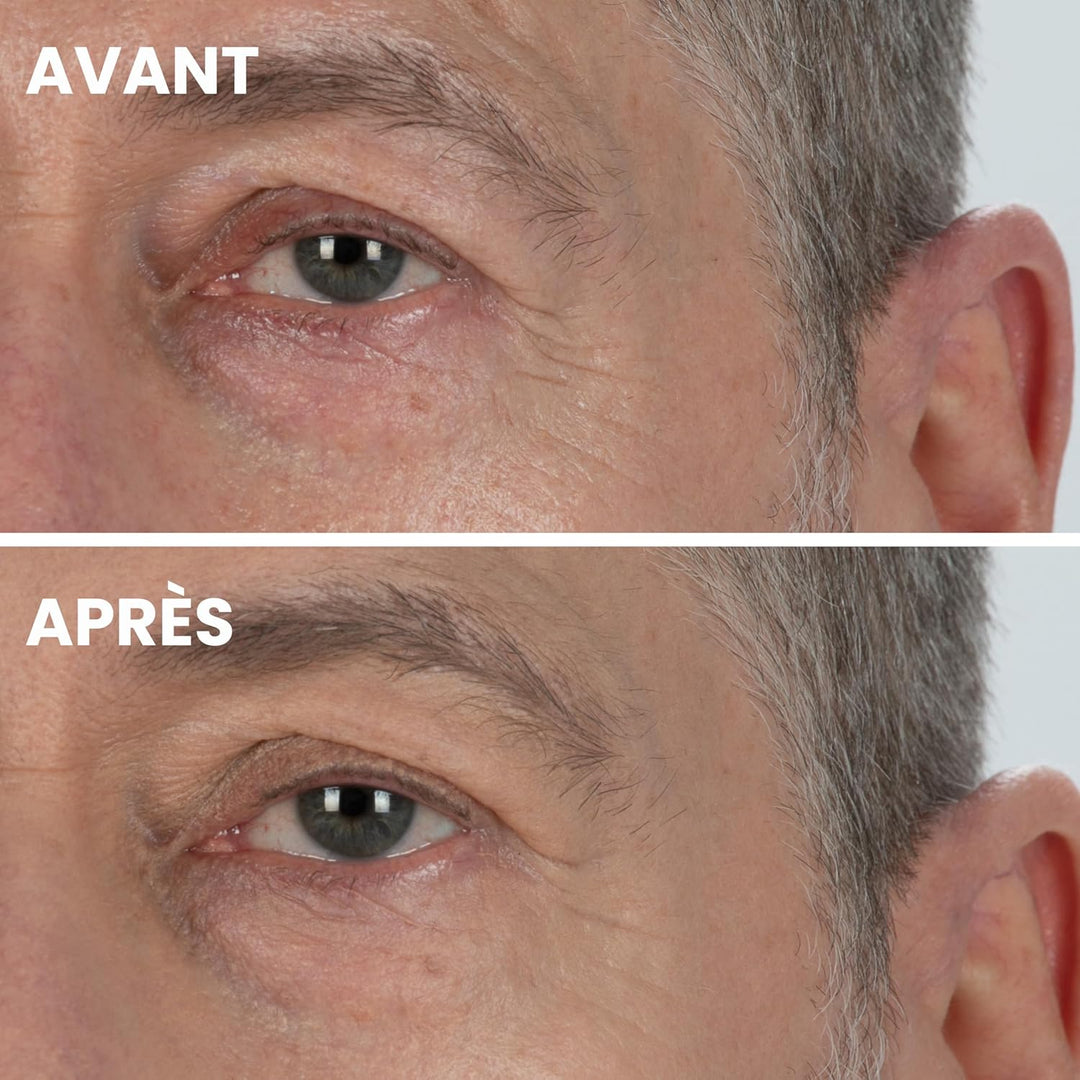 KDERM - Lifter Flüssigkeits-Concealer für die Augen – Anti-Aging-Pflege mit Bio-Peptiden von Kappa-E