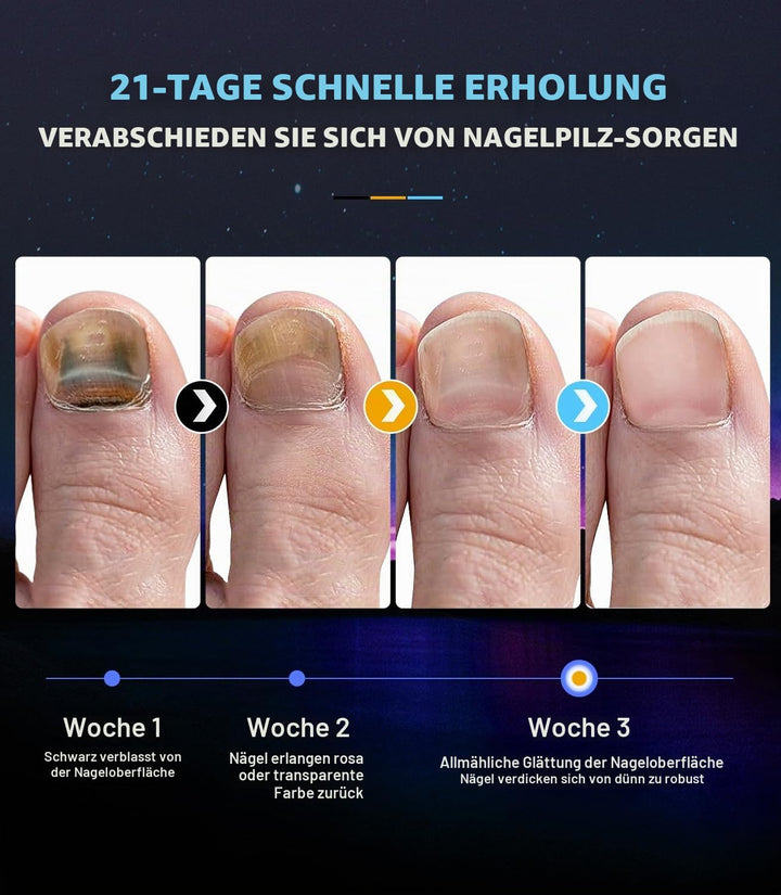 2025 Upgrade Nagelpilz Lasergerä【mit Zeitanzeige - 30s/60s/99s】Faltbares Gerät Nagelpilz Lasergerä f