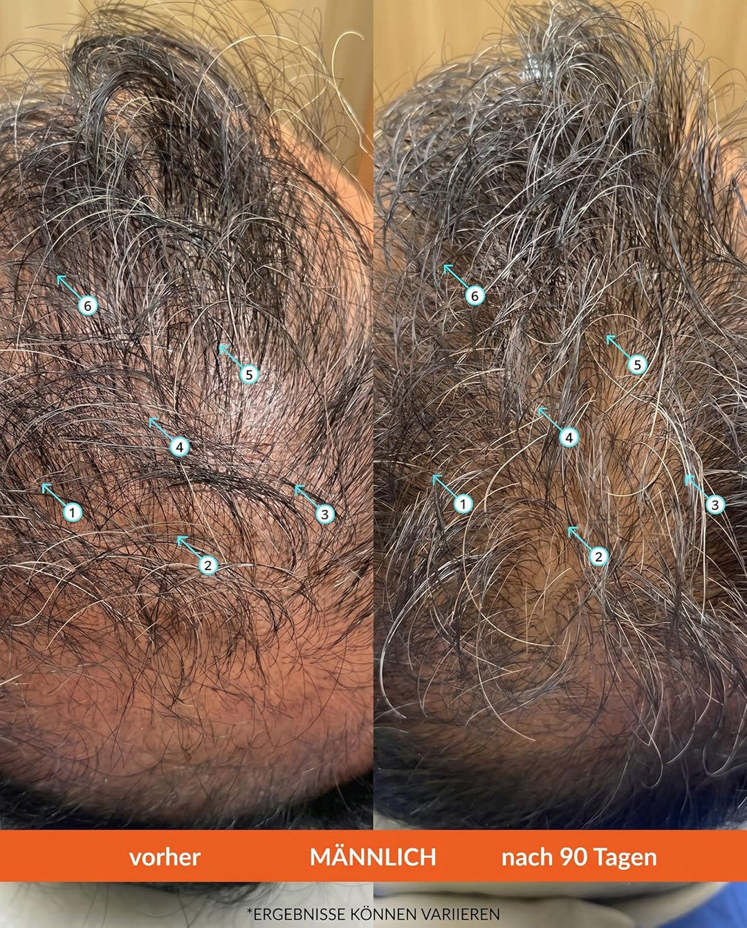 Revita Shampoo gegen dünner werdendes Haar von DS Laboratories - Voluminisierendes, verdickendes Sha