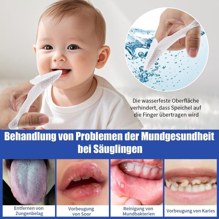 Mandelsteinentferner Set 3-in-1, Einfaches Tonsillenstein Entfernen + 32 Mundreinigungsfingerhandsch