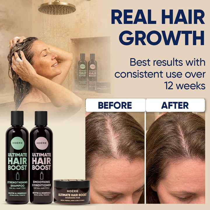 Moerie Ultimate Mineral Shampoo and Conditioner Set - Vegan Friendly, Paraben Free, Hair Growth Prod