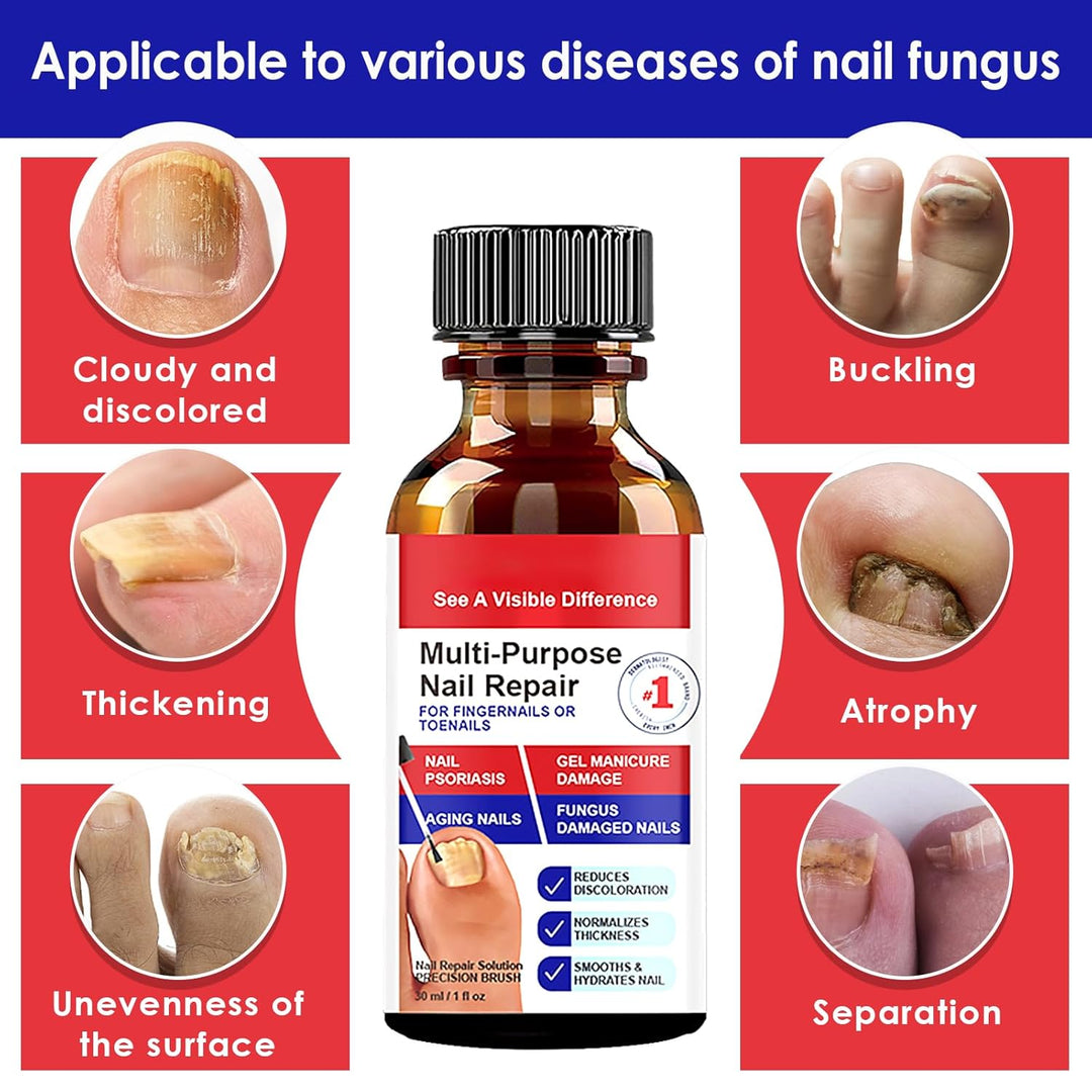 Nagelaufbauserum & Nagelpflege, Nagel Aufbau Serum, Nagelpflege Pflegend, Schutz & Stärkung Nägel, M