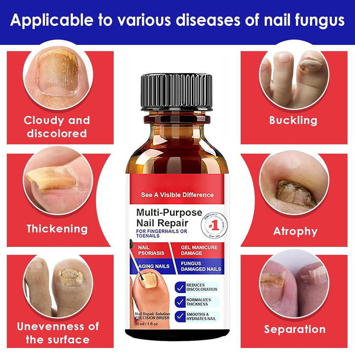 Nagelaufbauserum & Nagelpflege, Nagel Aufbau Serum, Nagelpflege Pflegend, Schutz & Stärkung Nägel, M