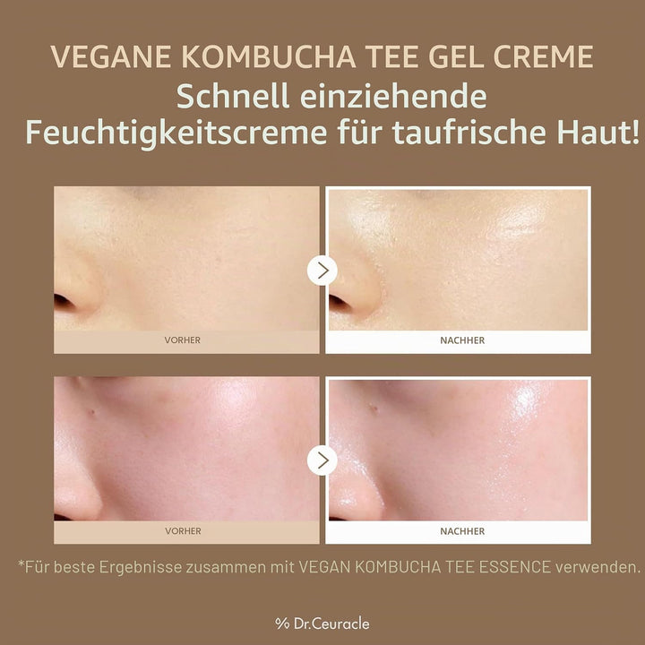 Dr Ceuracle Vegan Kombucha Tea Gel Cream 75g