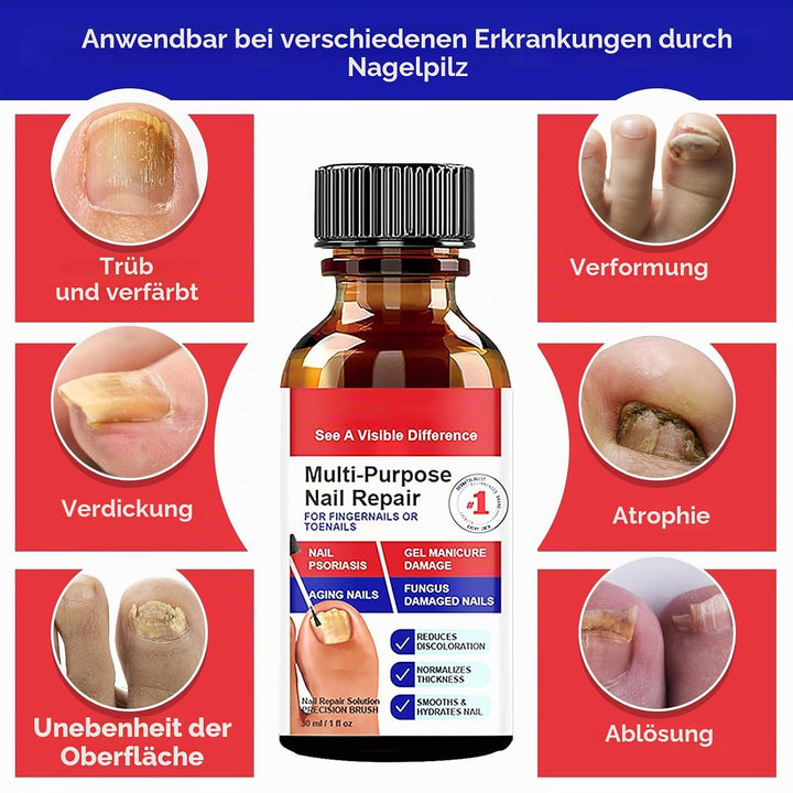 Nagelaufbauserum &amp; Nagelpflege, Nagel Aufbau Serum, Nagelpflege Pflegend, Schutz &amp; Stärkung Nägel, M