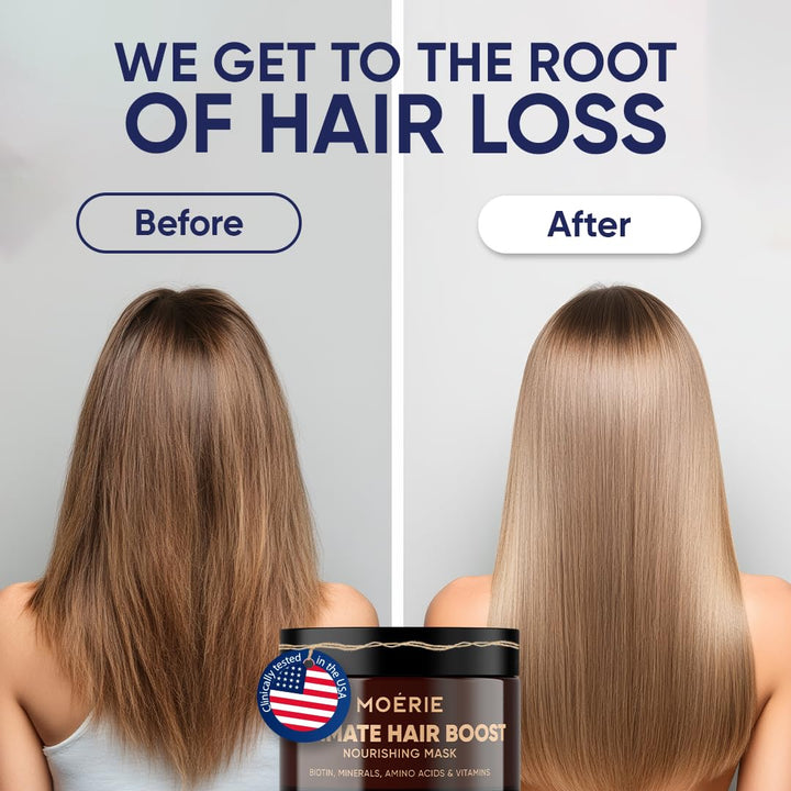 Moerie Hair Growth & Repair Mask - Restorative, Vegan-Friendly Treatment for Longer, Thicker, Fuller