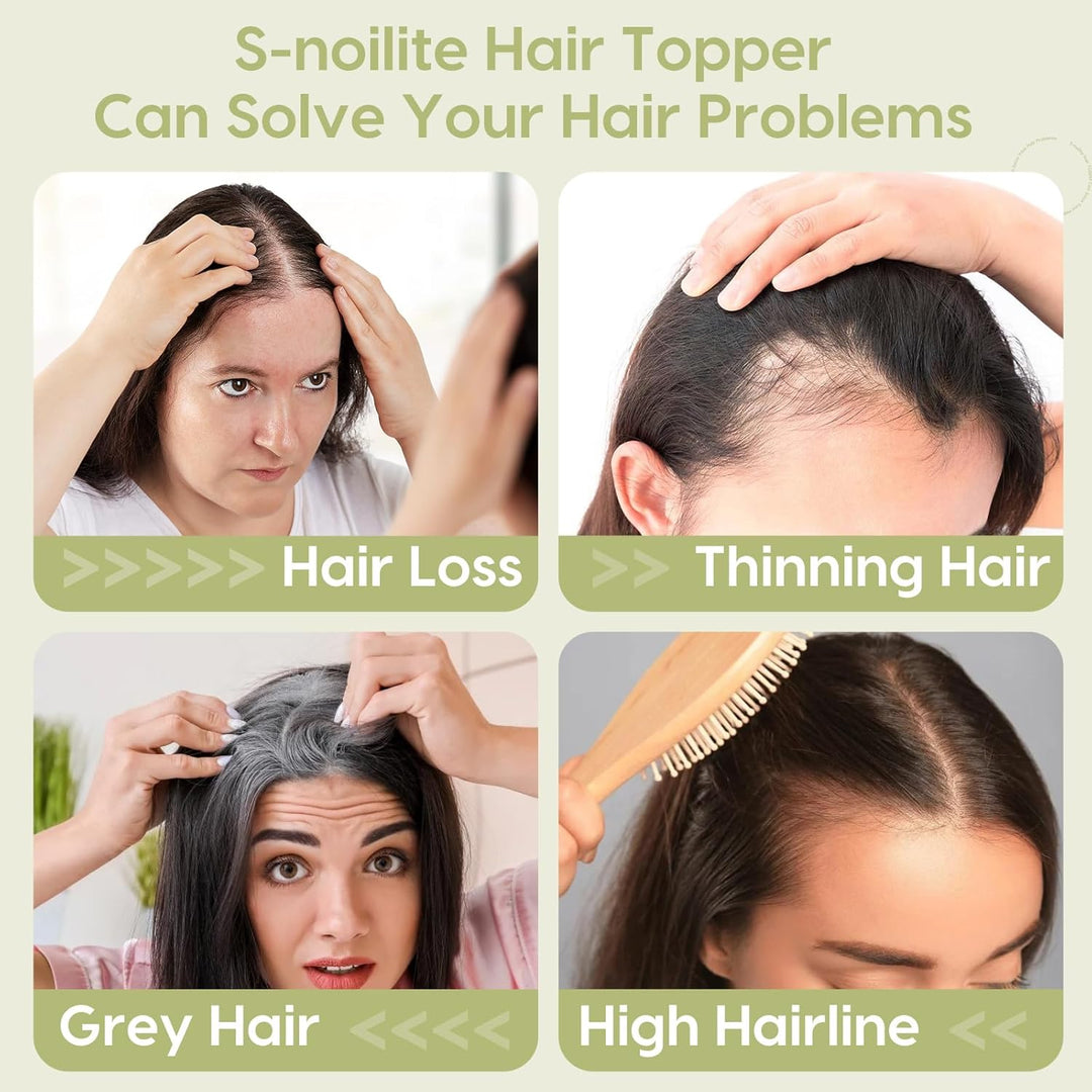 S-noilite Echthaar Hair Topper für Frauen mit Pony Haarteile für Dünnes Haar Echtes Menschliches Haa