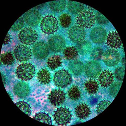AmScope MU1000 10MP Standbild- und Livebildmikroskop Digitalkamera und Bearbeitungs-, Messsoftware,