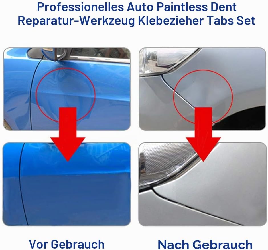 Keenso Auto Karosserie Dellenreparatur Saugnapf Set, 30 Stk Auto Dellenentferner Ausbeulen Saugnapf